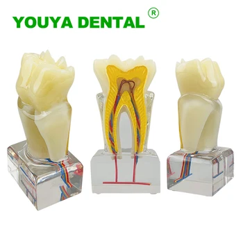 Dentare Model Demonstrativ Dinți Anatomie Model Cu Tupeu Vasele De Dentist Endodontie Dentara Studiu De Predare Model Cristal